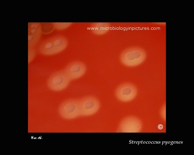 s.pyogenes hemolysis